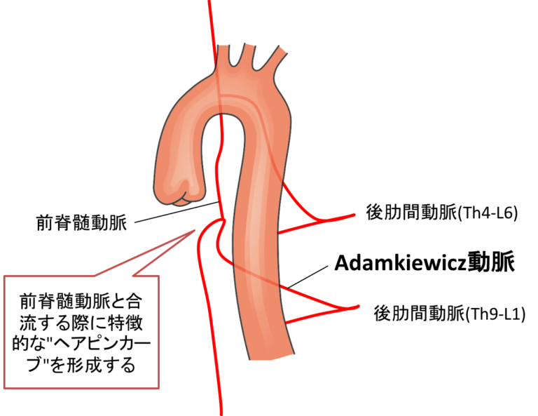 Adamkiewicz動脈障害による脊髄梗塞112回医師国家試験A問題45 Adamkiewicz動脈障害による脊髄梗塞112回医師国家試験A問題45