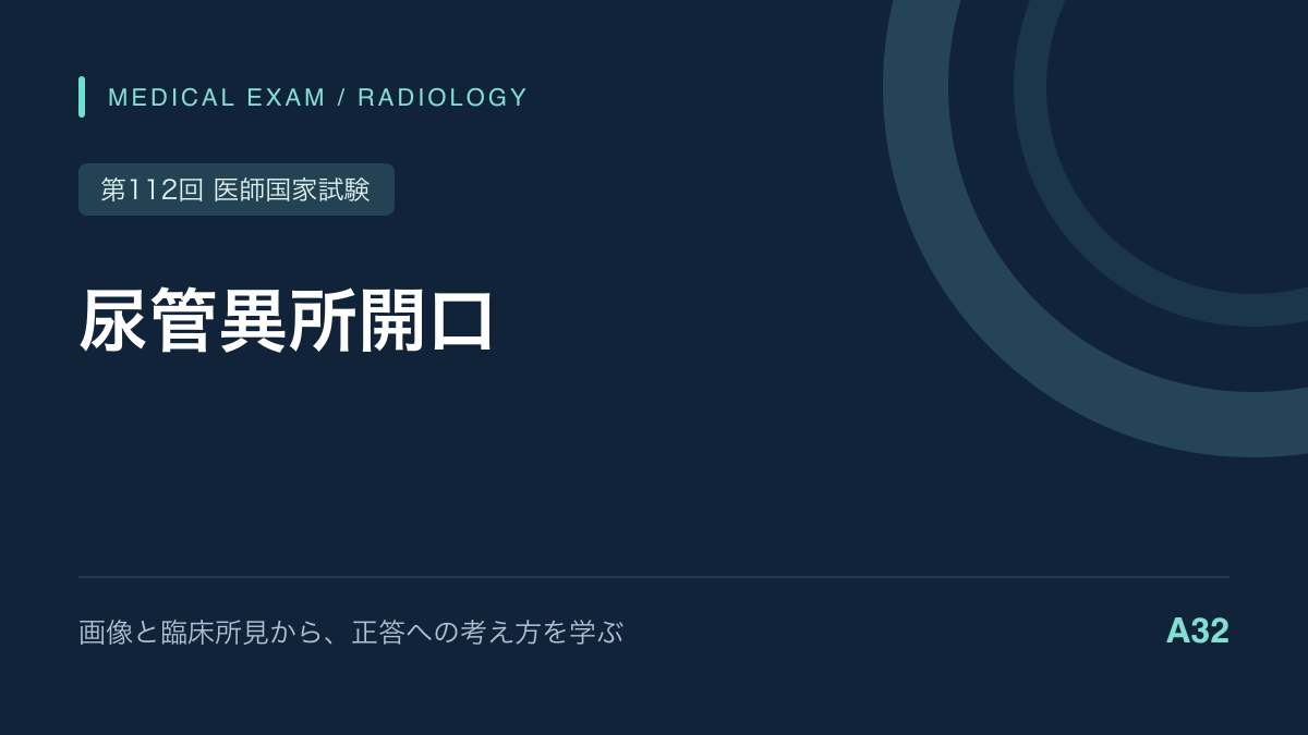 女児の持続性尿失禁と尿管異所開口｜重複尿管を整理｜第112回医師国家試験A32