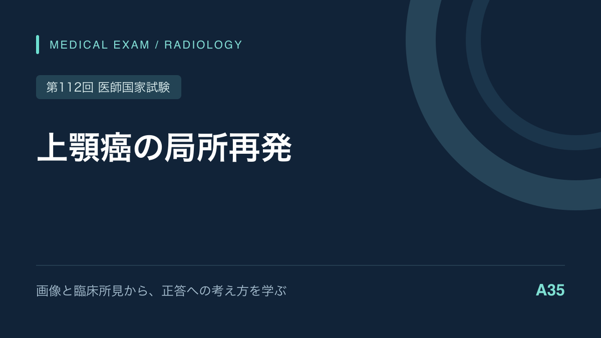 上顎癌治療後の頬部腫脹｜MRIで局所再発を疑う｜第112回医師国家試験A35