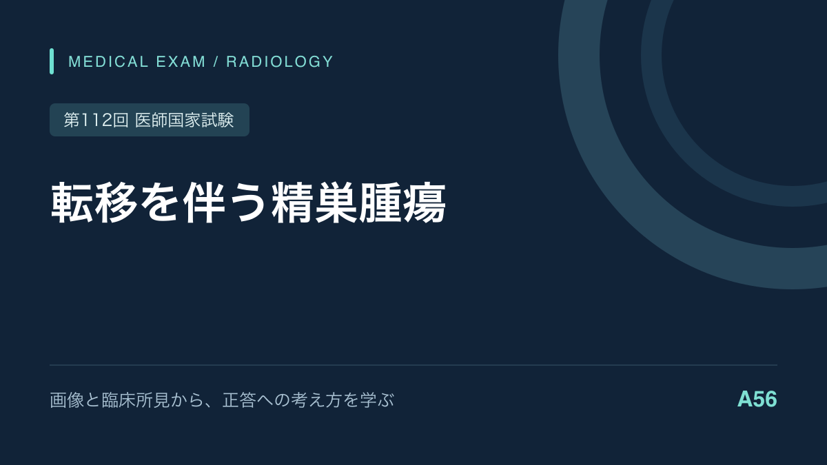 精巣腫瘍の肺・後腹膜転移｜まず高位精巣摘除術｜第112回医師国家試験A56