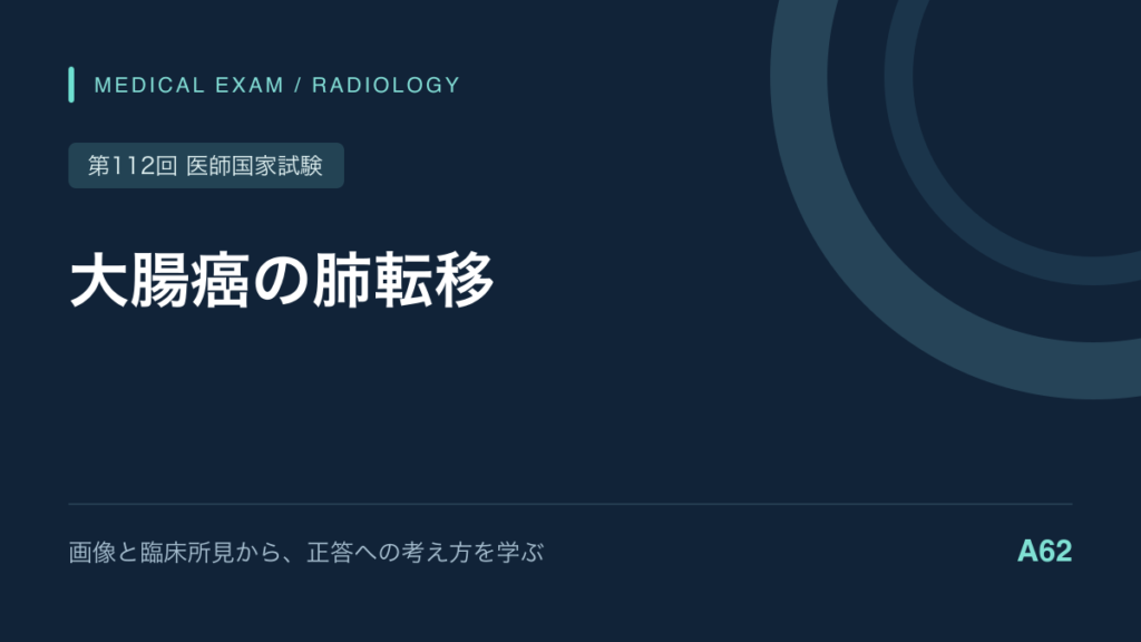 大腸癌の肺転移は手術できる?|両側肺結節の治療方針|第112回医師国家試験A62